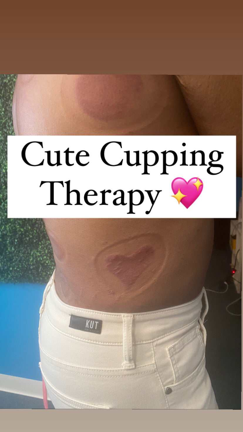 Cupping Therapy Session